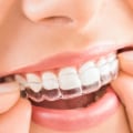 Do Your Teeth Move the First Week of Invisalign Treatment?