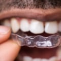 How Often Should You Visit the Dentist During Invisalign Treatment?