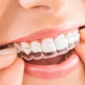 What are the Disadvantages of Invisalign?