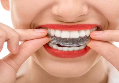 What is the Best Age for an Invisalign Treatment?