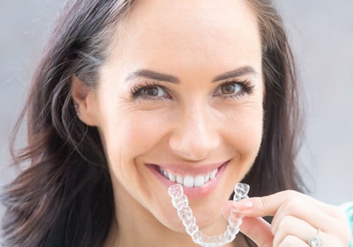 Can Clear Aligners Straighten Crooked Teeth and Close Gaps?