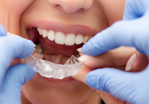 Can You Have an Allergic Reaction to Invisalign Clear Aligners?