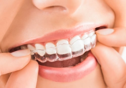 What are the Disadvantages of Invisalign?